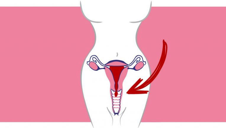 Tratamiento incontinencia urinaria en los mochis sinaloa